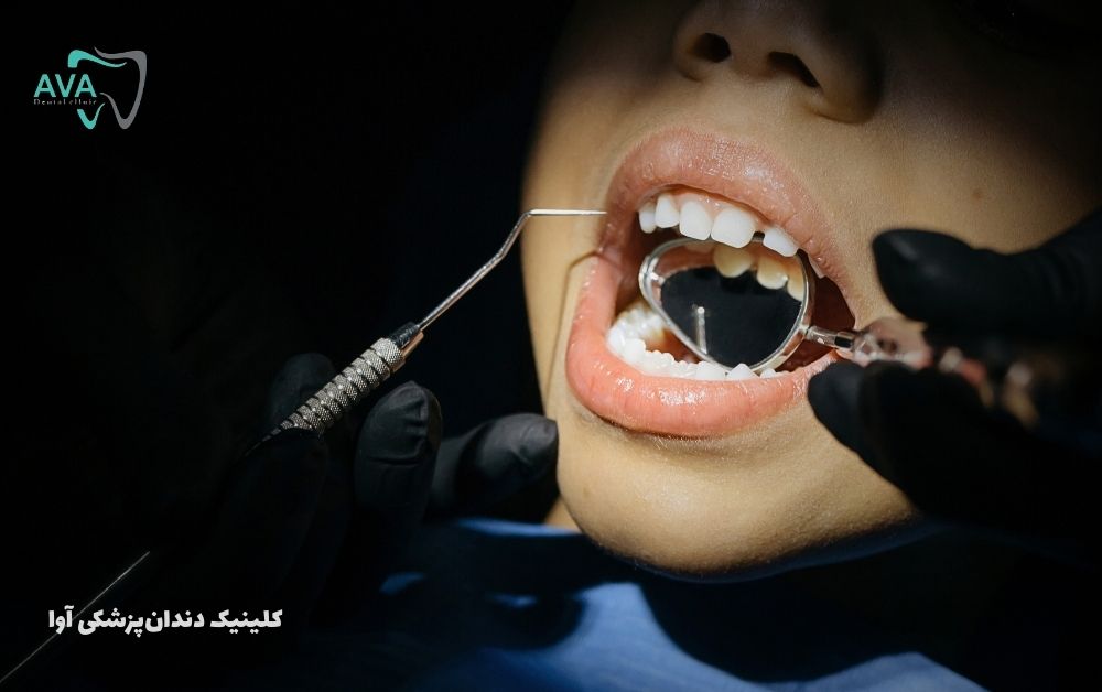 کلینیک دندانپزشکی آوا متخصص دندانپزشکی کودکان گوهردشت 2 دندانپزشکی کودکان گوهردشت