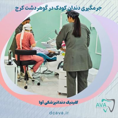 جرمگیری دندان کودک در گوهر دشت کرج | لبخندی سالم از همان کودکی 5 جرمگیری دندان کودک در گوهردشت