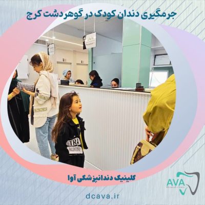 جرمگیری دندان کودک در گوهر دشت کرج | لبخندی سالم از همان کودکی 2 جرمگیری دندان کودک در گوهردشت