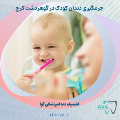 جرمگیری دندان کودک در گوهر دشت کرج | لبخندی سالم از همان کودکی 3 جرمگیری دندان کودک در گوهردشت