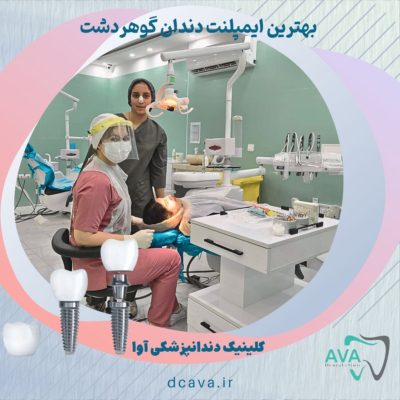 بهترین ایمپلنت دندان گوهردشت 1 ایمپلنت دندان گوهردشت