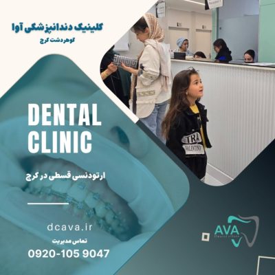 ارتودنسی قسطی در کرج