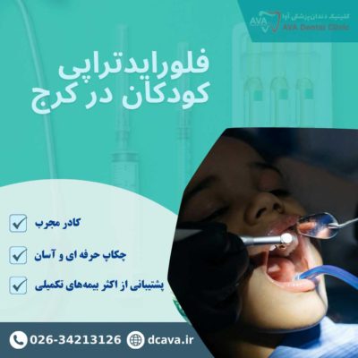 فلورایدتراپی کودکان در گوهردشت کرج | پیشگیری مطمئن از پوسیدگی دندان 4 فلورایدتراپی کودکان در کرج