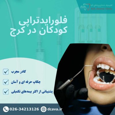 فلورایدتراپی کودکان در گوهردشت کرج | پیشگیری مطمئن از پوسیدگی دندان 2 فلورایدتراپی کودکان در کرج
