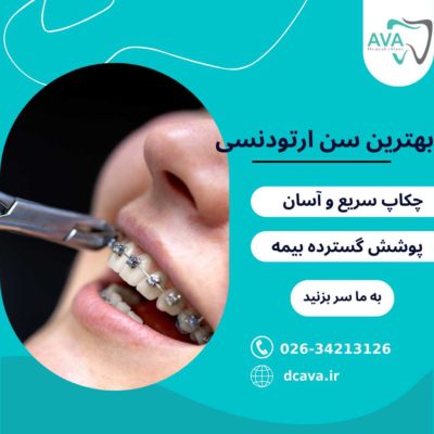بهترین سن ارتودنسی | کودکان و بزرگسالان + نکات تخصصی 1 بهترین سن ارتودنسی