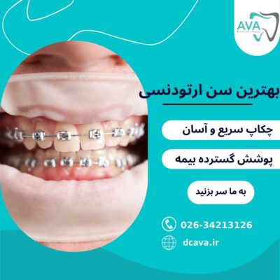 بهترین سن ارتودنسی | کودکان و بزرگسالان + نکات تخصصی 3 بهترین سن ارتودنسی