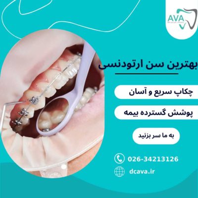 بهترین سن ارتودنسی | کودکان و بزرگسالان + نکات تخصصی 2 بهترین سن ارتودنسی