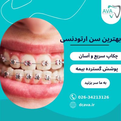 بهترین سن ارتودنسی | کودکان و بزرگسالان + نکات تخصصی 5 بهترین سن ارتودنسی