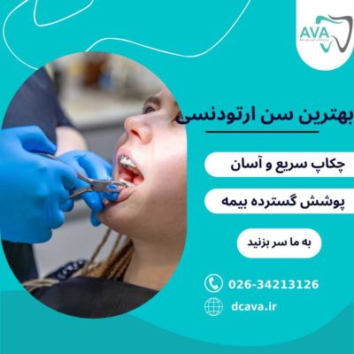 بهترین سن ارتودنسی | کودکان و بزرگسالان + نکات تخصصی 4 بهترین سن ارتودنسی