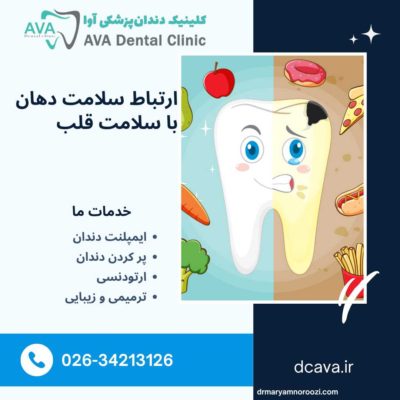 ارتباط سلامت دهان با سلامت قلب؛ تأثیر دندانهای سالم بر عملکرد قلب 4 ارتباط سلامت دهان با سلامت قلب