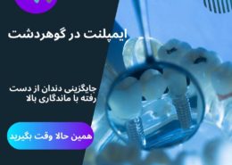 ایمپلنت در گوهردشت