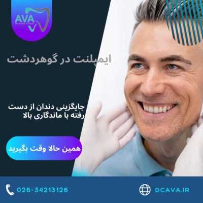 ایمپلنت در گوهردشت | جایگزینی دندان از دست رفته با ماندگاری بالا در کلینیک دندانپزشکی آوا 5 ایمپلنت در گوهردشت