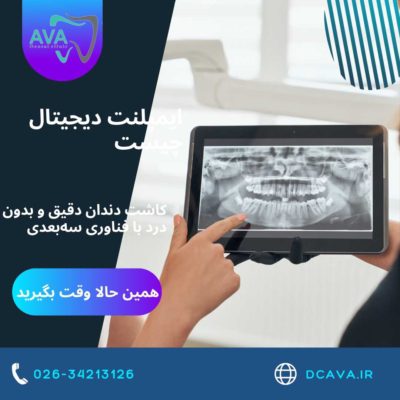 ایمپلنت دیجیتال چیست؟ | کاشت دندان دقیق و بدون درد با فناوری سهبعدی در کلینیک آوا 4 ایمپلنت دیجیتال چیست