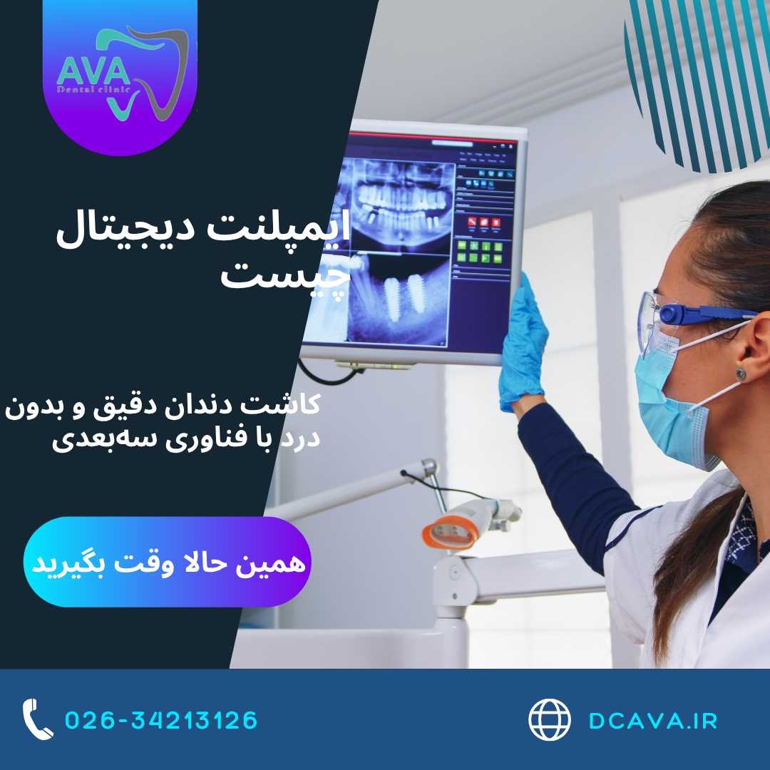 ایمپلنت دیجیتال چیست