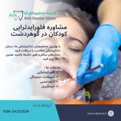 مشاوره فلورایدتراپی کودکان در گوهردشت | محافظت هوشمند از دندانهای کوچک در کلینیک دندانپزشکی آوا 4 مشاوره فلورایدتراپی کودکان در گوهردشت