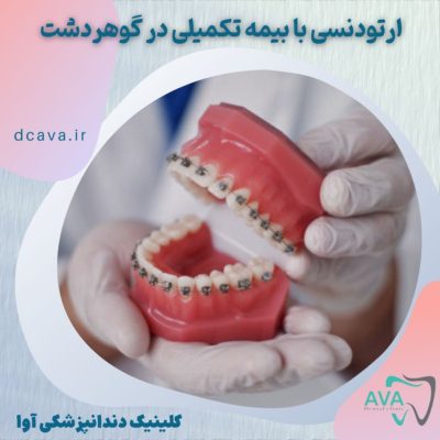 ارتودنسی با بیمه تکمیلی در گوهردشت در کلینیک دندانپزشکی آوا 1 ارتودنسی با بیمه تکمیلی در گوهردشت