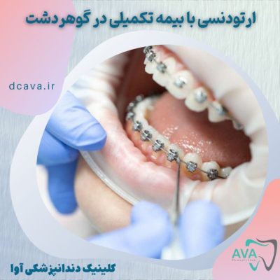 ava-dc-1404-09-11 ارتودنسی با بیمه تکمیلی در گوهردشت
