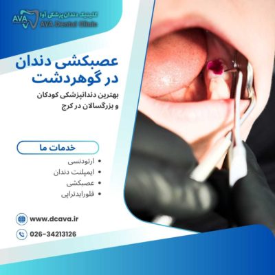 عصبکشی دندان در گوهردشت | راهنمای کامل درمان ریشه با بهترین متخصصان 🦷 3 عصبکشی دندان در گوهردشت