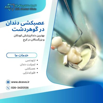 عصبکشی دندان در گوهردشت | راهنمای کامل درمان ریشه با بهترین متخصصان 🦷 4 عصبکشی دندان در گوهردشت