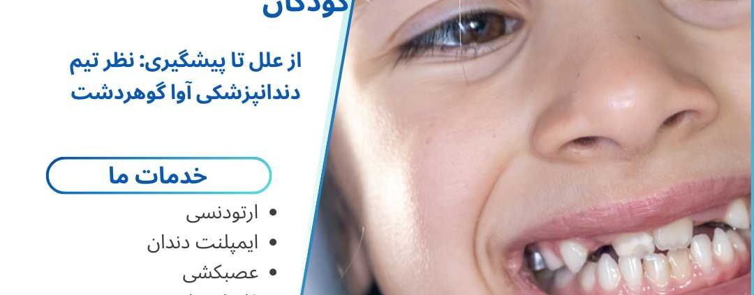 اشتباهات رایج والدین در مراقبت از دندانهای شیری کودکان | راهنمای کامل و کاربردی 1 اشتباهات رایج والدین در مراقبت از دندانهای شیری کودکان