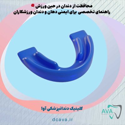 🥊 محافظت از دندان در حین ورزش: راهنمای تخصصی آوا برای ایمنی دهان و دندان ورزشکاران 15 محافظت از دندان در حین ورزش