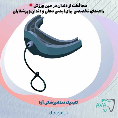 🥊 محافظت از دندان در حین ورزش: راهنمای تخصصی آوا برای ایمنی دهان و دندان ورزشکاران 14 محافظت از دندان در حین ورزش