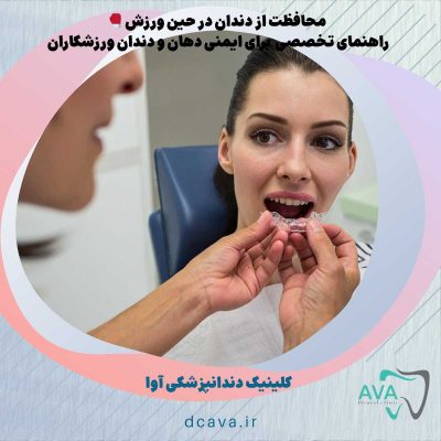 🥊 محافظت از دندان در حین ورزش: راهنمای تخصصی آوا برای ایمنی دهان و دندان ورزشکاران 16 محافظت از دندان در حین ورزش