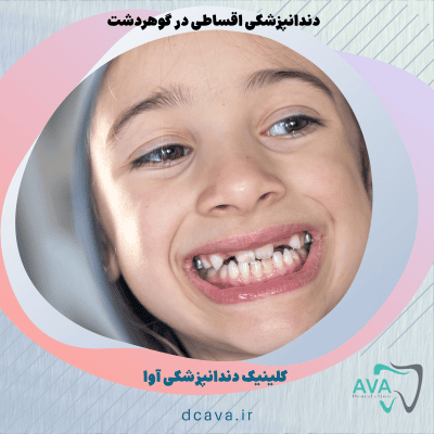 دندانپزشکی اقساطی در گوهردشت