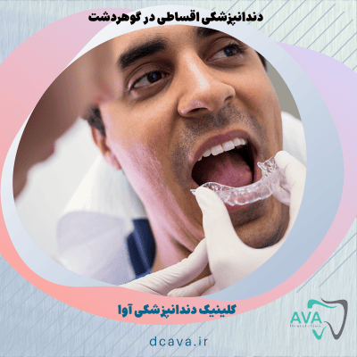 دندانپزشکی اقساطی در گوهردشت